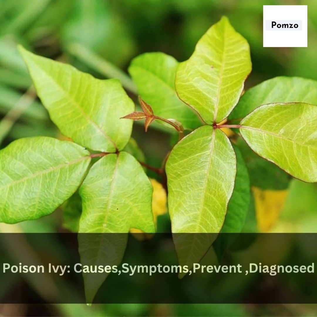 Navigating The Itch: Understanding How Long Poison Ivy Lasts